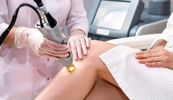 لیزر موهای زائد